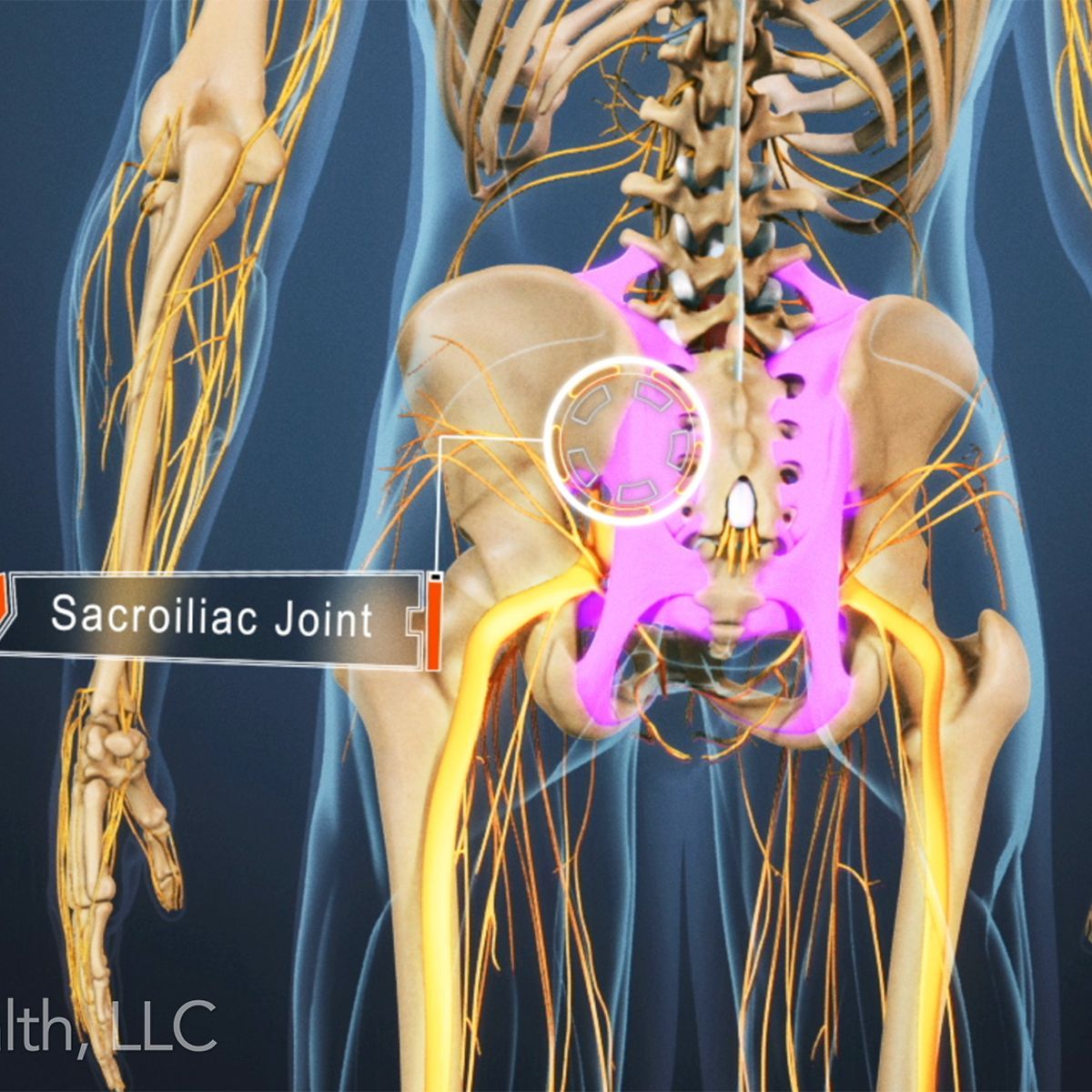 Polymyalgia rheumatica polymyositis diseases autoimmune fibromyalgia myositis symptoms chronic medicalschoolquicktopics gravis arthritis rheumatoid term